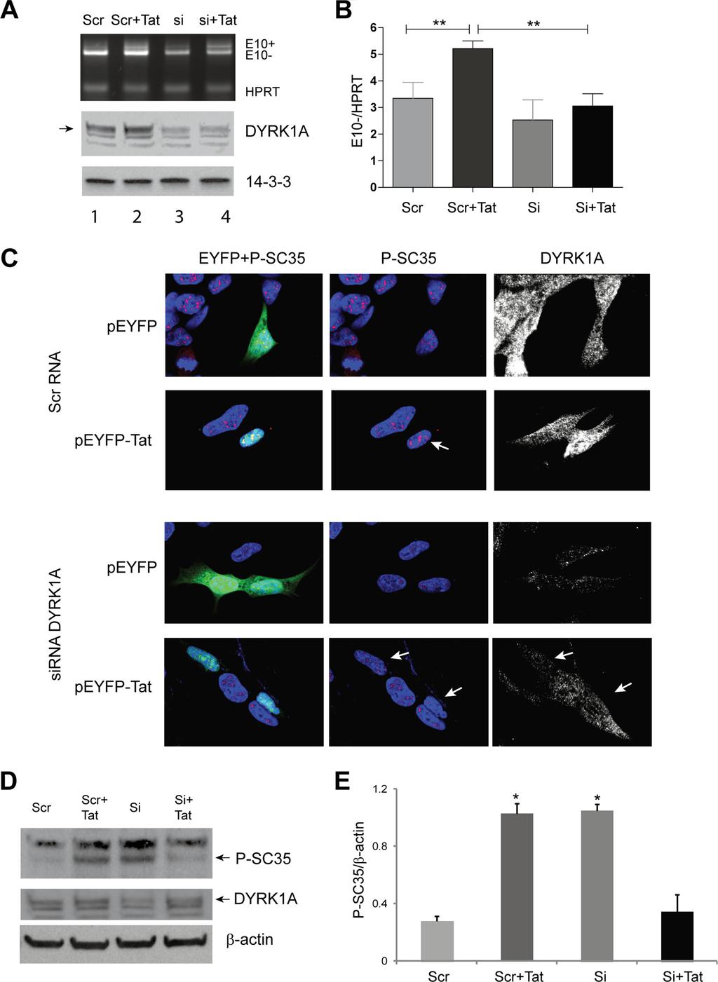 FIGURE 9. Silencing DYRK1A inhibits Tat-mediated increase in P-SC35 and promotes TAU 10 exclusion.