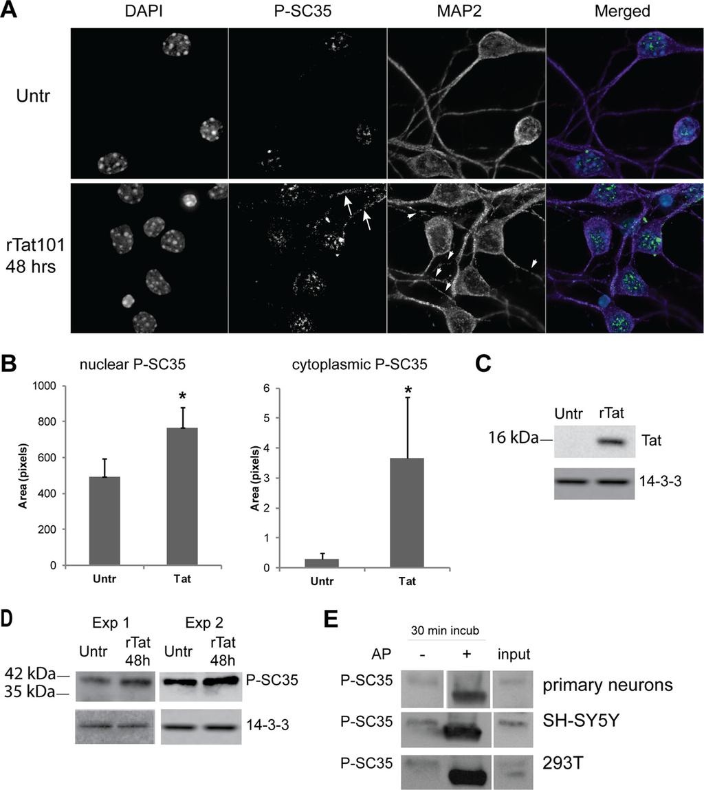 FIGURE 3. Treatment of mouse embryonic cortical neurons with Tat results in increased phosphorylation of SC35 protein.