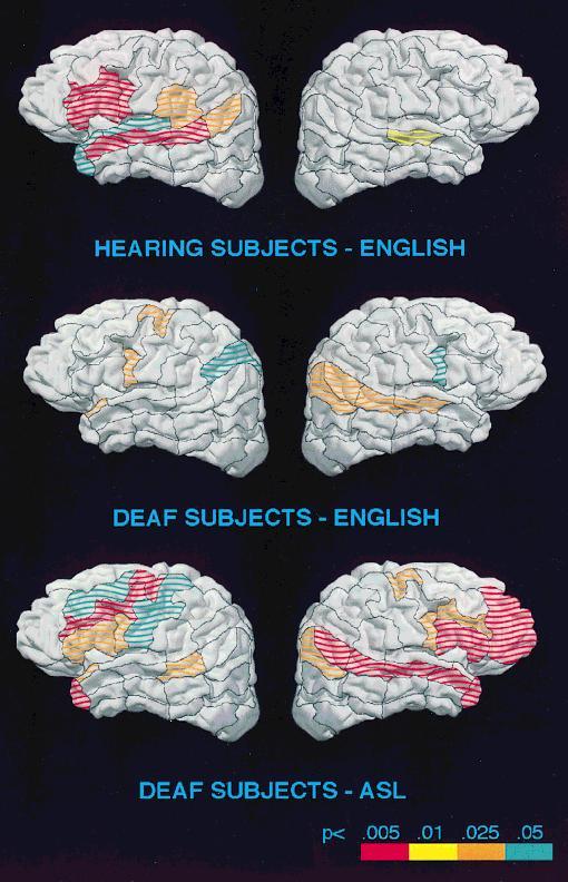 that is missing in the deaf subjects (Neville and Mills, 1997).