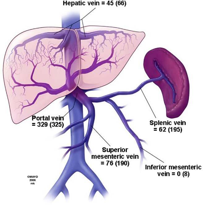 202 THATIPELLI ET AL CLINICAL GASTROENTEROLOGY AND HEPATOLOGY Vol. 8, No. 2 Figure 1. Splanchnic venous thrombus location. Number and location of isolated venous segment thrombosis are presented.