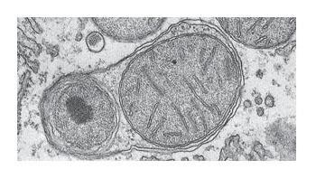 Abnormal lysosomes can cause fatal diseases (Lysosomal storage diseases) which interfere with