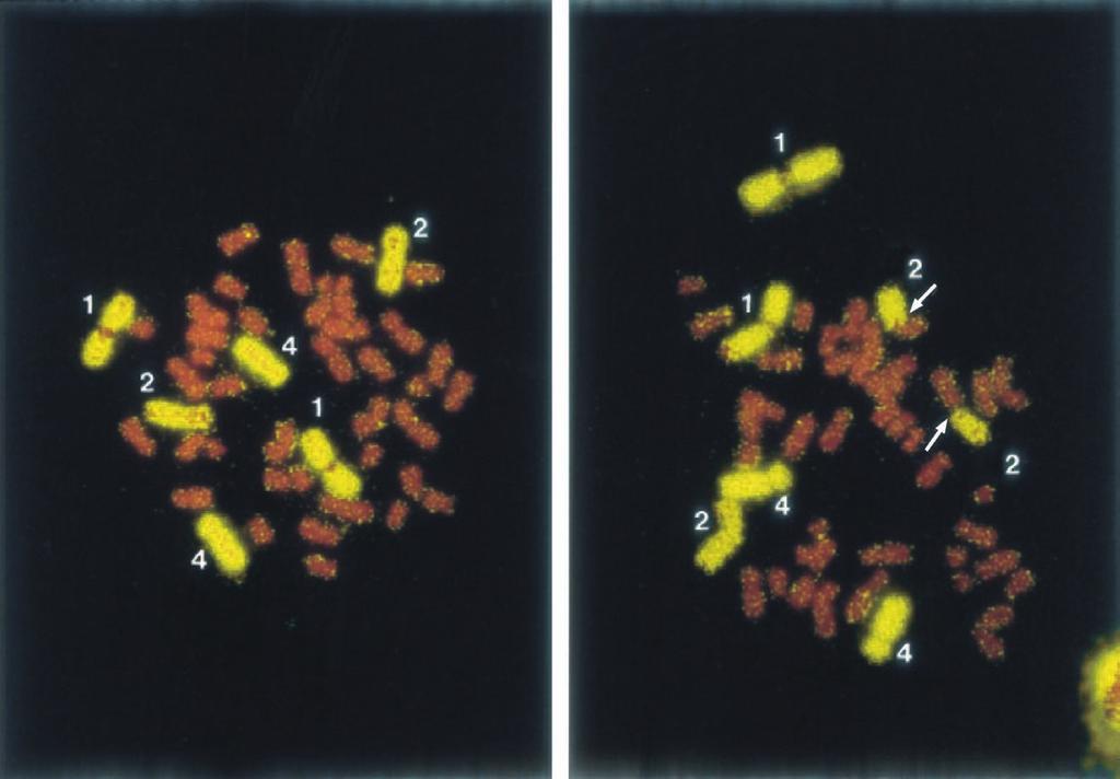 4 Radiation dosimetry B Biological dosimetry Figure 4. Metaphase stained with FISH. The left metaphase shows a normal cell and the right, a translocation indicated by arrows.
