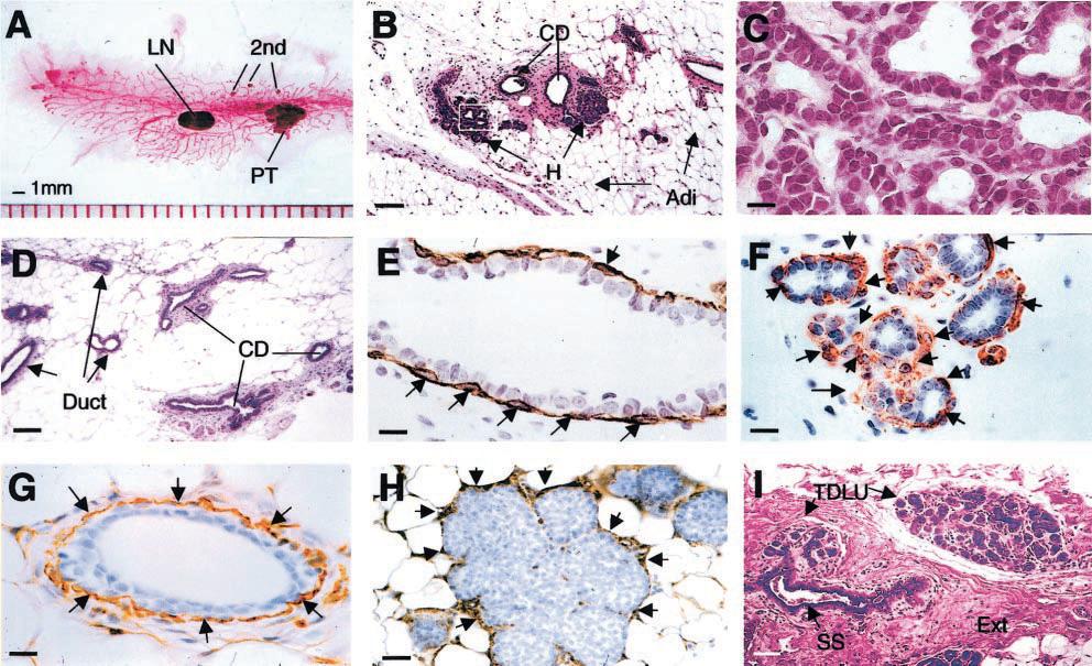 PyMT Mouse Model for Human Breast Cancer 2115 Figure 1. Early premalignant tumor in PyMT mice is comparable to human normal breast.