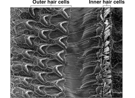 SEM of Cochlear Hair Cells Physiology of Hearing -- Middle Ear Eardrum vibrates quite easily