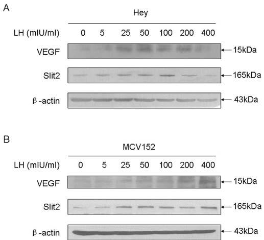 In A and B, the upper panel shows the protein level of VEGF after treatment with a series of concentrations of LH for 48 h, the middle panel presents the blot of Slit2, while the lower panel shows
