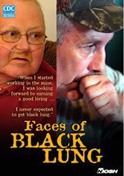 Faces of Black Lung DVD Same type of disease as silicosis DRDS interviewed two coal miners that have contracted CWP Miners discuss the importance of