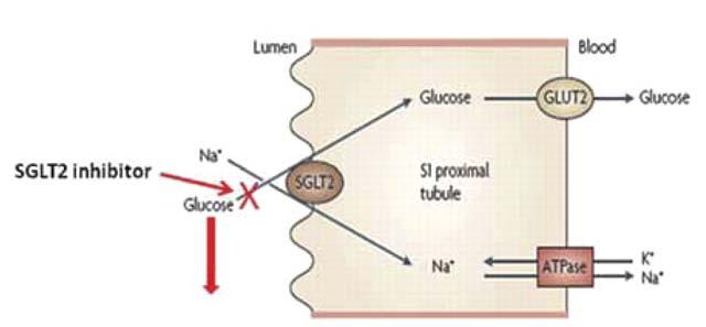 Glucose reabsorption by the proximal convoluted tubule Dokken B. Diabetes Spectr 2012;25:29 36. Copyright 2011 American Diabetes Association, Inc.