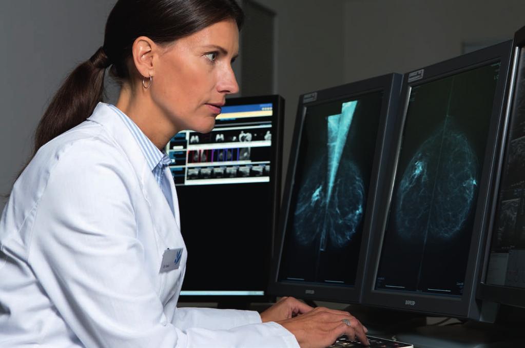 Explore breast imaging views IntelliSpace Breast helps you keep pace with the demands of your radiology department by giving you the