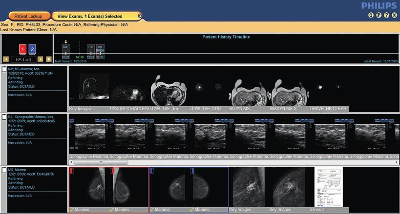 Enhance your view Manage your patients mammography, ultrasound, and MR* images on an intelligently arranged timeline of results from previous studies.