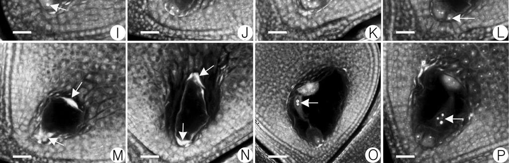 G, The two nuclei (arrows) were still located at the micropylar pole in an abnormal two-nucleate embryo sac although the embryo sac size was increased; H and I, Five-nucleate embryo sac.