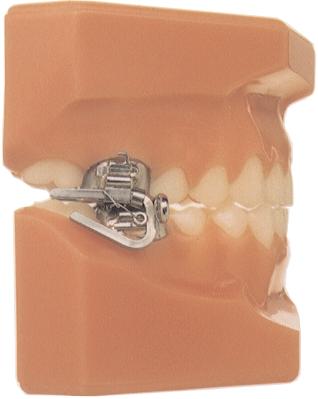 AOA allesee orthodontic appliances In partnership with your practice VolUME 1, number 1, 1997 The MARA Appliance Our premiere issue features Dr.
