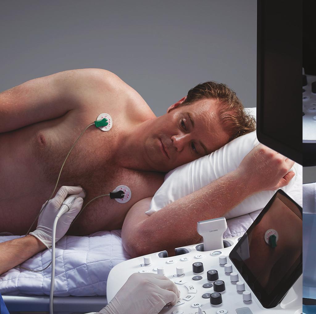 Abdomen Cardiac Musculoskeletal ElastoScanTM E-StrainTM Auto IMT+ A diagnostic ultrasound technique for imaging