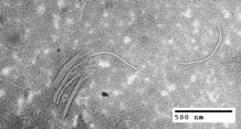 Rhabdovirus particles are often difficult to find in known infected plants, but