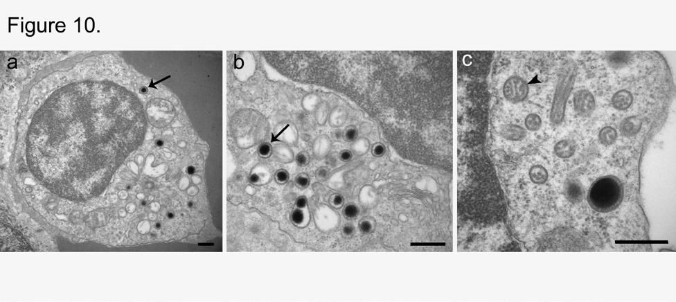 Images from J. Lovy. Figure 10. Immune cells in the spleen of cyprinid fish containing a complex network of granules.