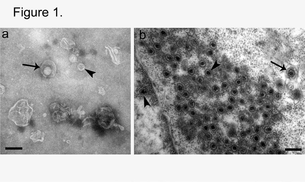 Figure 1. Cyprinid herpesvirus (CyHV), seen using two methods of processing fish tissues.