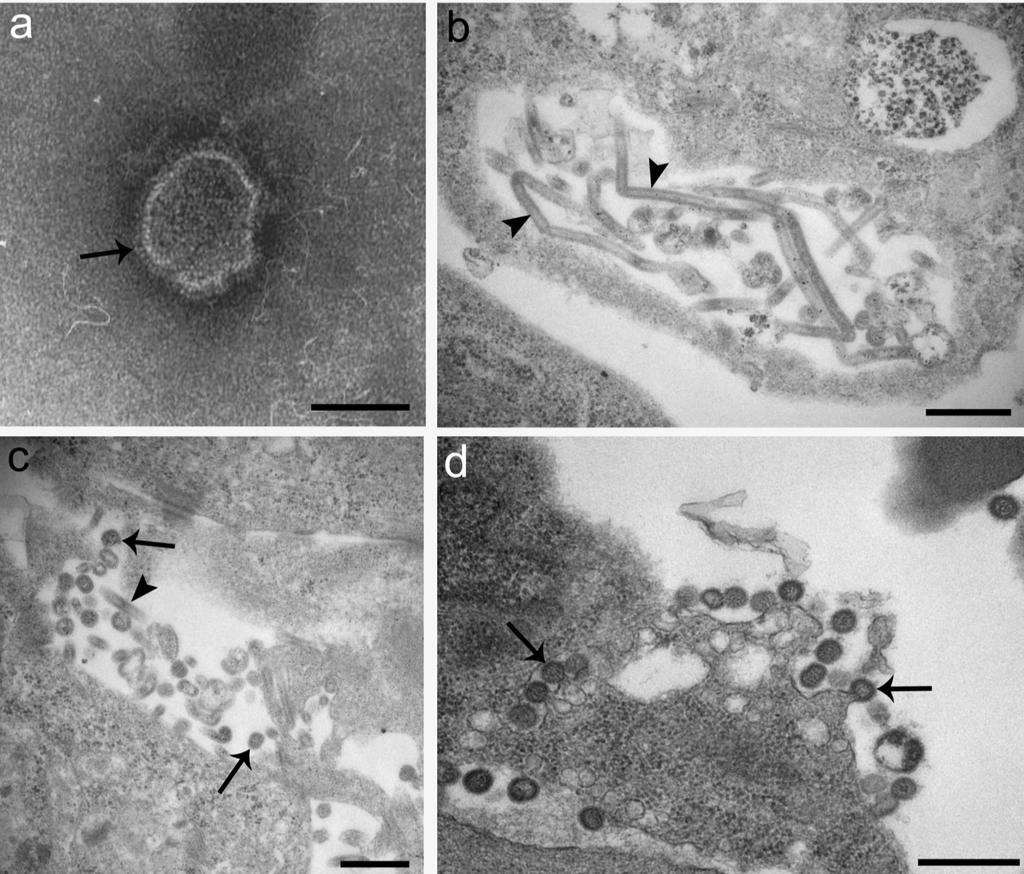 2.1.2 Electron Microscopy for Diagnostic Virology - 1 Figure 2. Infectious salmon anemia virus (ISAV) seen by various methods of processing.