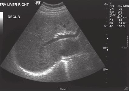 4 Chapter 1: Ultrasound Nomenclature Ultrasound Texture Homogeneous: organ parenchyma is uniform in echogenicity (Figure 1-4).