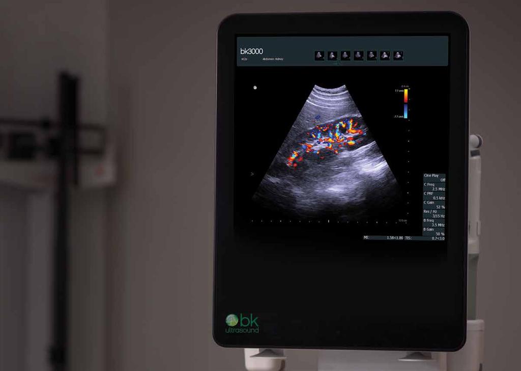 DESIGNED WITH A FOCUS ON UROLOGY In Urology, you have distinct needs and expectations for an ultrasound system. You ll find that the bk3000 has been designed specifically to meet these needs.