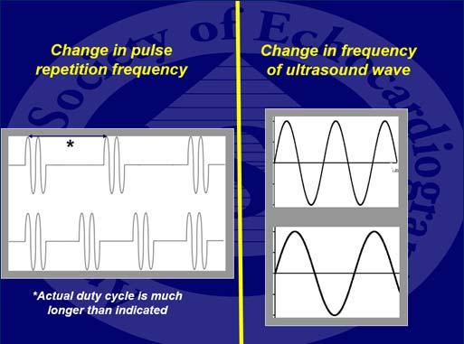 4 7 MHz ultrasound waves Sound created and detected in the transducer