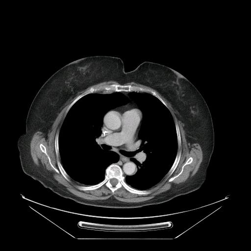 patient with colorectal