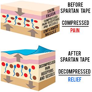 HOW DOES IT WORK The vision behind the Kinesiology taping system was to design a tape and taping style which would effectively provide support to muscles and reduce pain while maintaining a