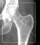 Talk to your doctor 14 Is it time for your next bone density scan? A commonly used bone density scan is called a DXA.