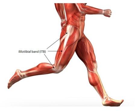 2. Iliotibial Band syndrome Iliotibial band (ITB) syndrome (so called runners knee although often seen in other sports e.g. cyclists and hill walkers).