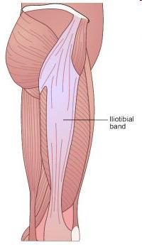 Iliotibial Band Syndrome Definition and Home