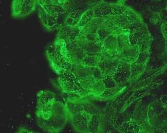 CANCER CELLS A Mock β4galnact-ii+
