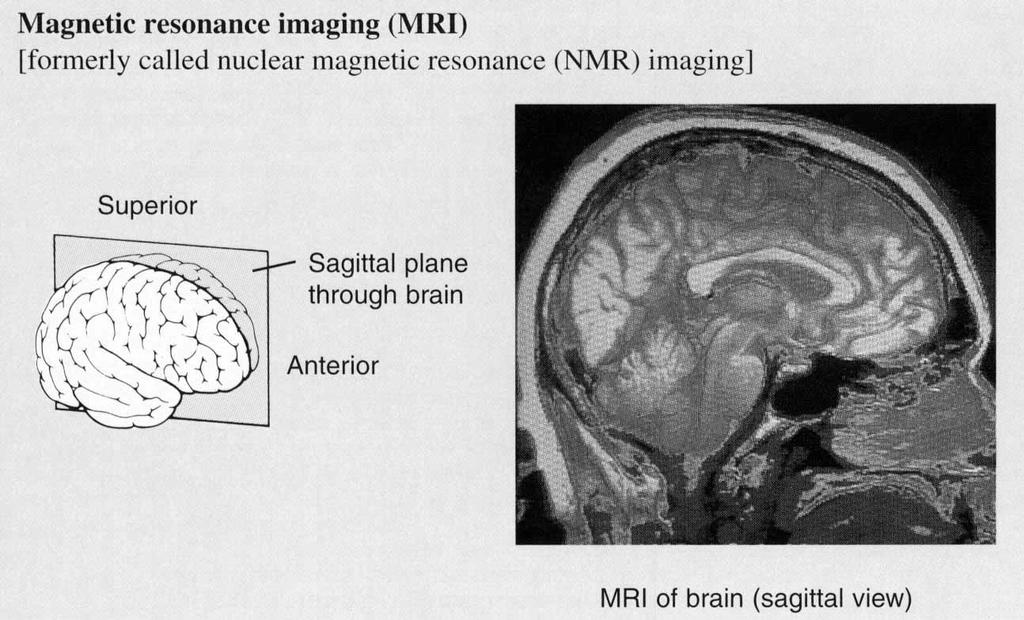 Magnetic Resonance Imaging (MRI) Body exposed to highenergy magnetic field Can not