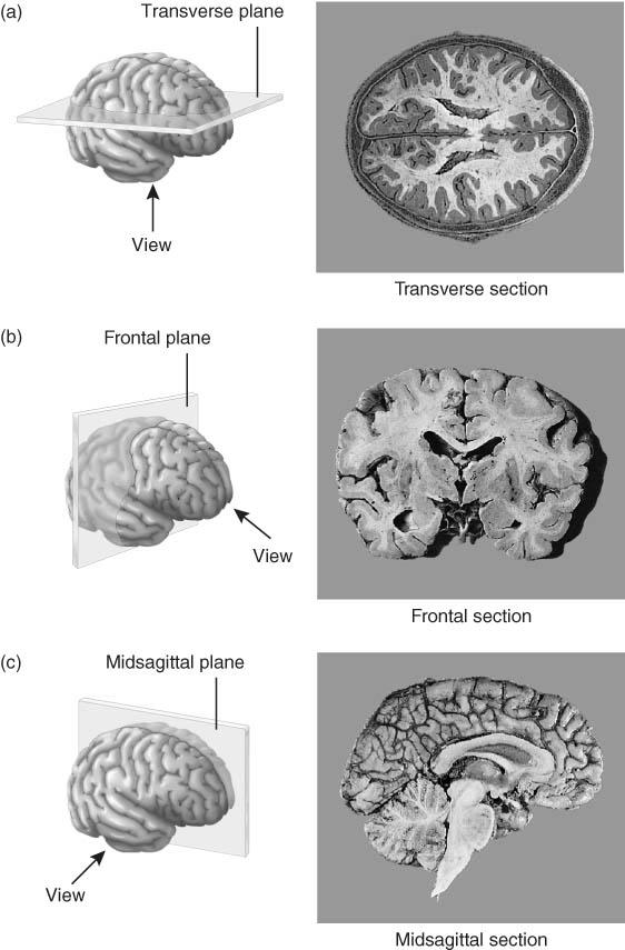 Planes and Sections of the Brain (3-D anatomical relationships revealed) Horizontal Plane Body Cavities Body cavities are spaces within the body that help protect, separate, and support internal