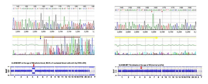 Is the aupd at 4q in ULSAM-697 associated with an acquired TET2 mutation?