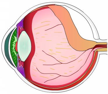 Retinal detachment is a serious eye condition. If it is not treated, it can lead to blindness. Each year, thousands of people are diagnosed with retinal detachment.
