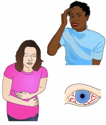 The symptoms of NAG include: Eye pain Eye redness Blurred vision Headache Nausea Vomiting If NAG is present, these symptoms will show up within a few hours of dilation.
