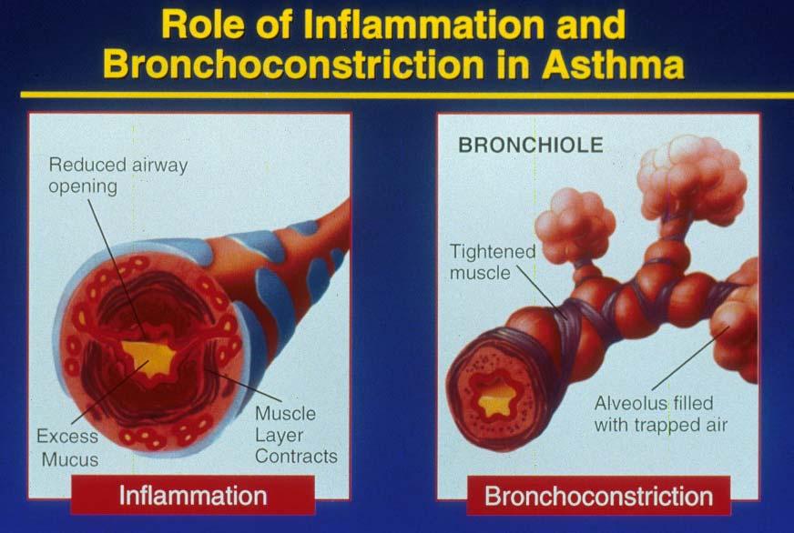 Inflammation and