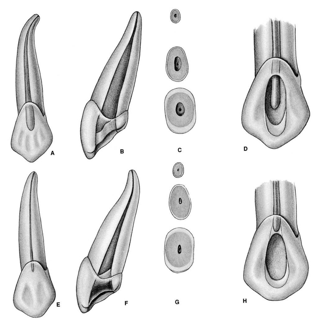 PLATE 6 Maxillary Canines Length of tooth Canal Lateral canals Apical ramifications Root curvature Average Length 26.0 mm One canal 24% 8% Straight 39% Maximum Length 28.