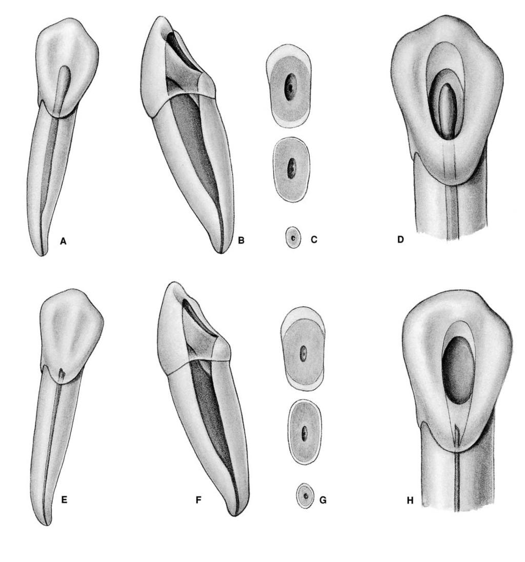 PLATE 10 Mandibular Canines Length of tooth Canals Lateral canals Root curvature Average Length 25.2 mm One canal 94% 9.5% Straight 68% Maximum Length 27.