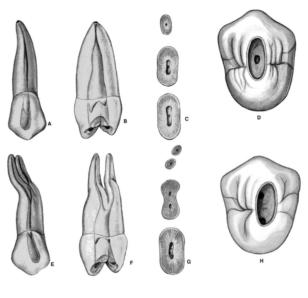 PLATE 14 Maxillary Second Premolars Length of tooth Canals Curvature Average Length 21 mm One canal 75% Straight 9.5% Maximum Length 23 mm One foramen Distal Curve 27.