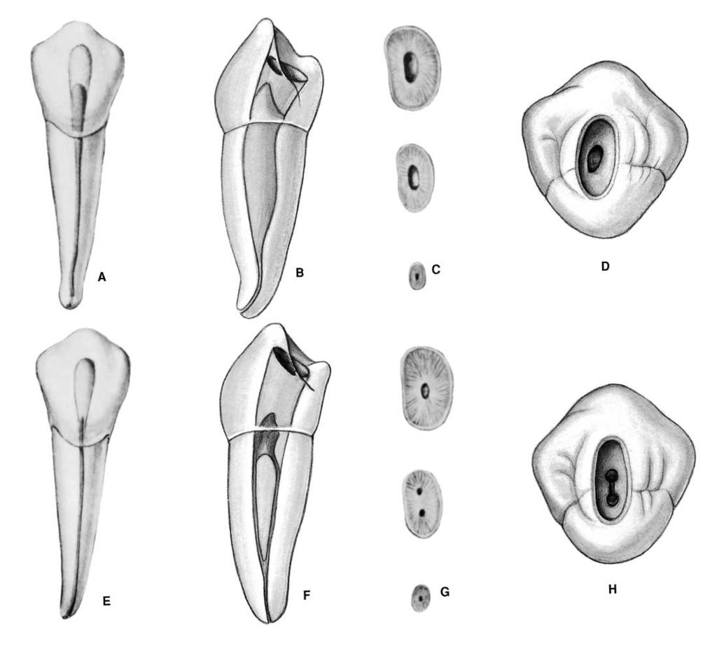 PLATE 17 Mandibular First Premolar Length of tooth Canals Curvature of root Average Length 22.1 mm One canal 73.5% Straight 48% Buccal Curve 2% Maximum Length 24.