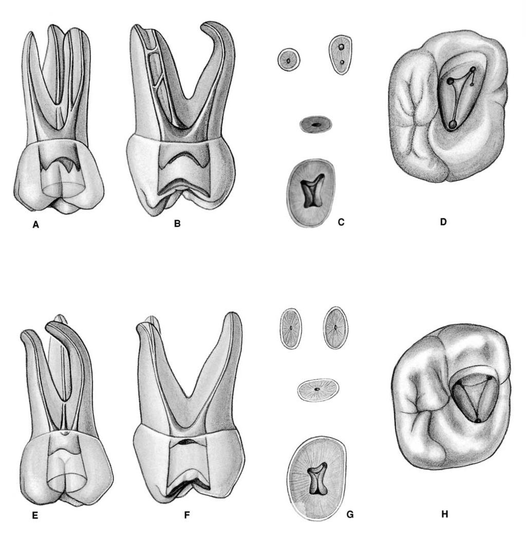 PLATE 21 Maxillary First Molars Curvature of roots Length of Tooth Mesiobuccal Distobuccal Palatal Canal Direction Palatal Mesial Distal Canals in the mesiobuccal root Average Length 19.9 mm 19.