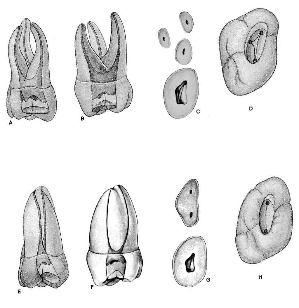 PLATE 22 Maxillary Second Molars Curvature of roots Length of Tooth Mesiobuccal Distobuccal Palatal Number of Roots Direction Palatal Mesial Distal Canals in the mesiobuccal root Average Length 20.