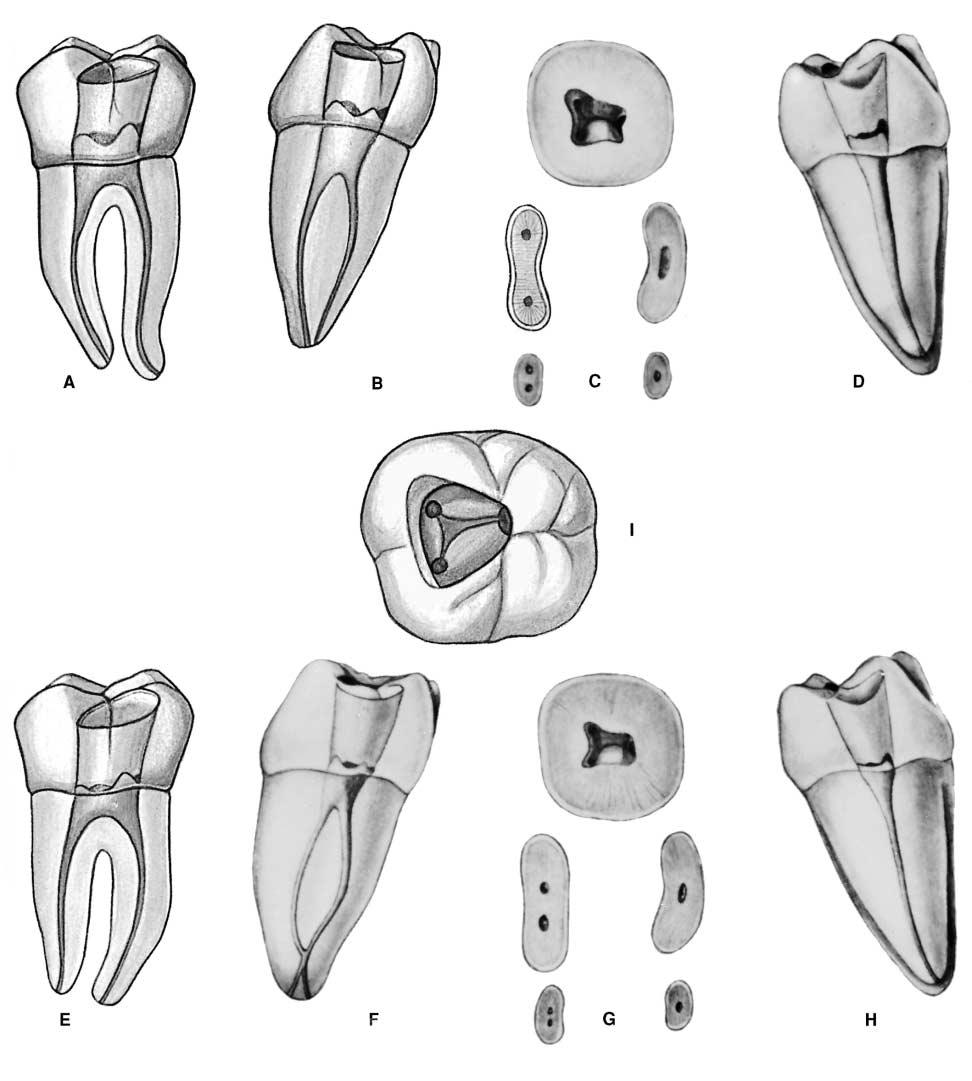 PLATE 26 Mandibular Second Molars Curvature of roots Canals Single Double Root Length of Tooth Mesial Distal Mesial Distal Direction Root Mesial Distal Average Length 20.9 mm 20.