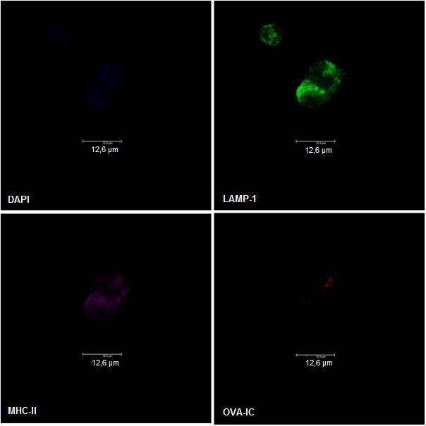 anti-lamp-1 Ab is stronger and less scattered throughout the cell than the anti-transferrin Ab signal. The next step would be to test the anti-lamp-1 Ab in DC of FcRγ -/- and NOTAM mice. Figure 18.