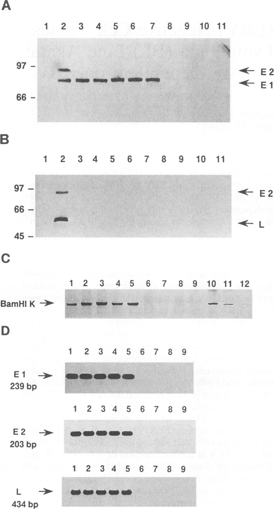3), EBNA-positive Akata cell clones (lanes 4 to 7), and EBNA-negative Akata cell clones (lanes 8 to 11).