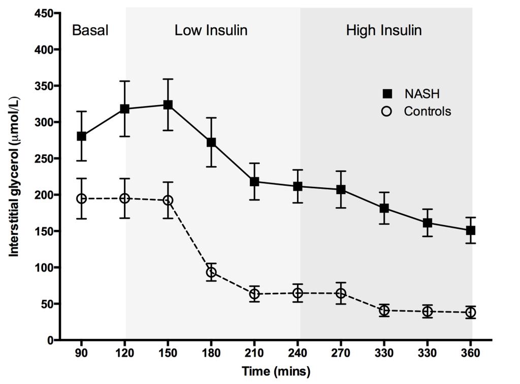 [A] [B] Figure 5-6. NASH is associated with significant abdominal SAT IR. [A] SAT interstitial fluid concentrations of glycerol during the 2-step hyperinsulinaemic euglycaemic clamp.