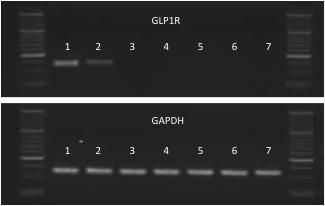 low to quantify via qpcr, GLP-1R gene expression was re-demonstrated on agarose gel using primers from Qiagen (bp 130).