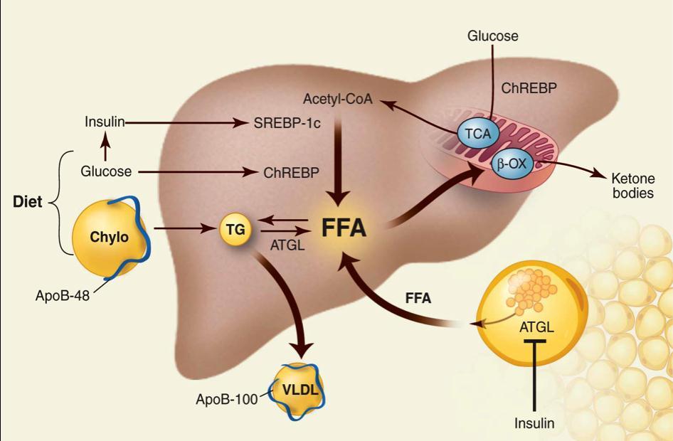 [1] [2] [3] [4] [1] Figure 1-1. Mechanisms of excess triglyceride accumulation in NAFLD.