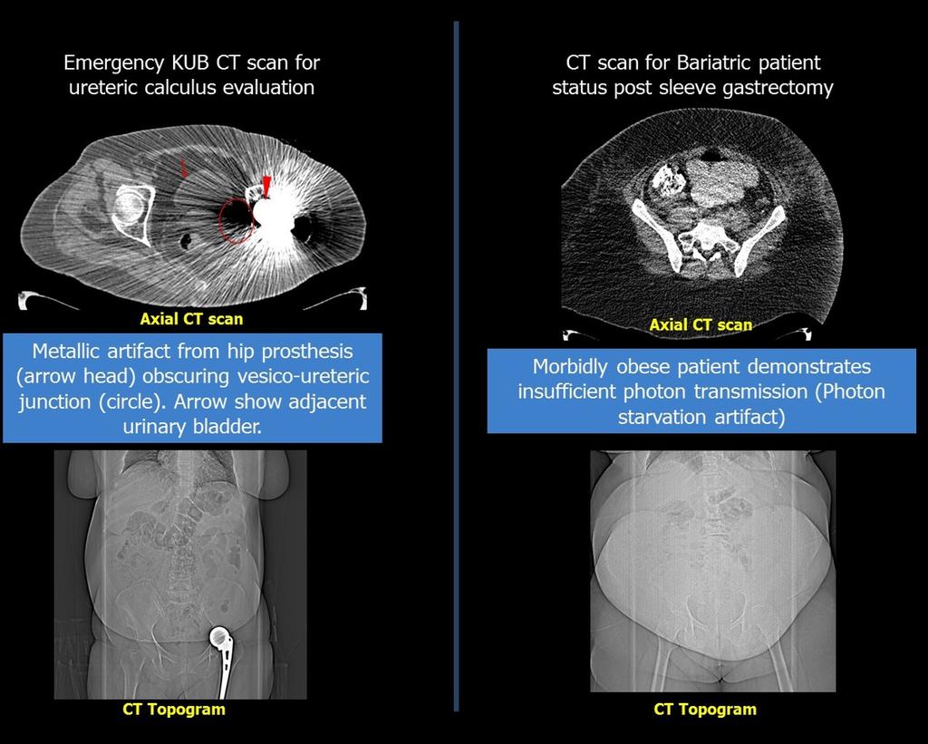 Fig. 1: Sample cases to illustrate some of the confronted sub-optimal CT scan studies.