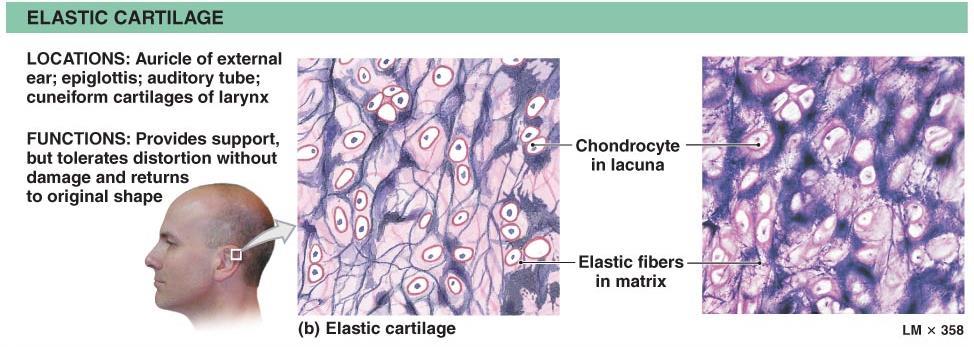 Supportive Connective Tissues Elastic cartilage