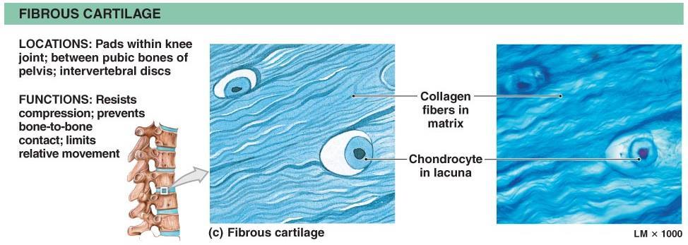 Supportive Connective Tissues Fibrous cartilage (fibrocartilage) Limits movement
